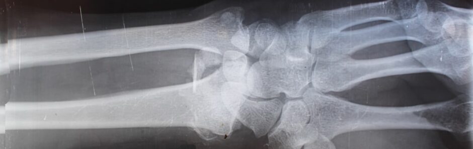 what kind of cases do personal injury lawyers handle